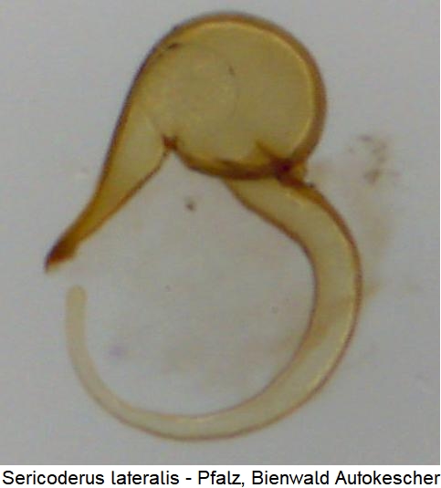 sericoderus_lateralis_sperm.jpg