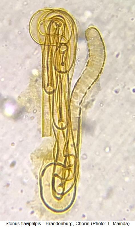 stenus_flavipalpis_sperm1.jpg