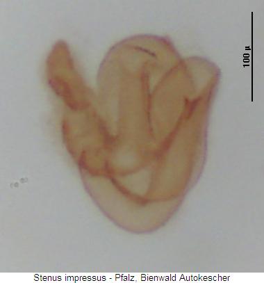stenus_impressus_sperm2.jpg
