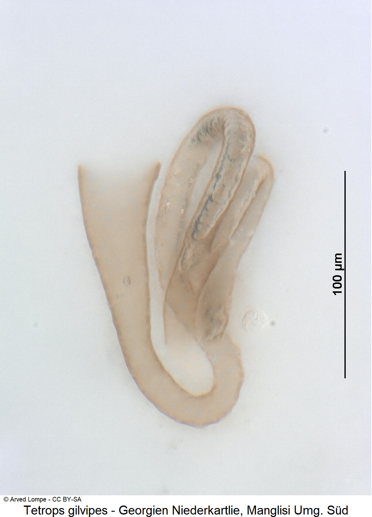 tetrops_gilvipes_ck18389422_sperm.jpg