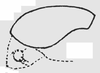 thorictodes_erraticus_kopf2.jpg