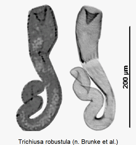 trichiusa_robustula_sperm.gif